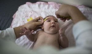 brazil-zika-birth-defects